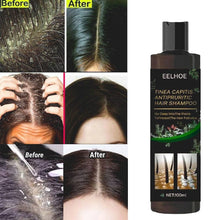 Tinea Capitis Antipruritic Hair Shampoo 100ml Each (Pack of 2)