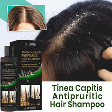 Tinea Capitis Antipruritic Hair Shampoo 100ml Each (Pack of 2)