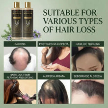 Kerarose Rosemary Hydrolyzed Keratin Shampoo 114 gm (Pack of 1)