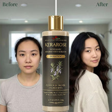 Kerarose Rosemary Hydrolyzed Keratin Shampoo 114 gm (Pack of 1)